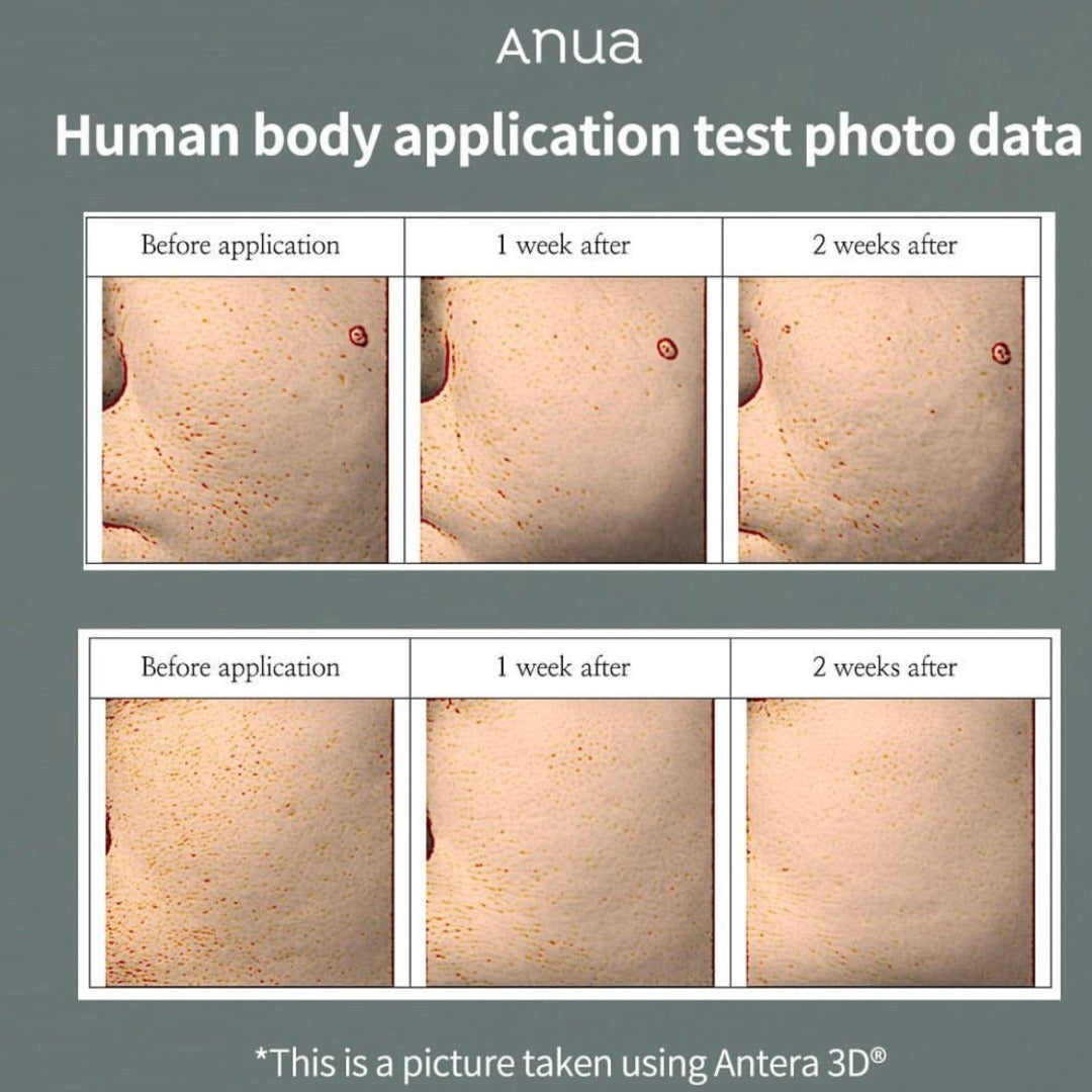 Anua Heart Leaf 77% Clear Pad, 160ml (70 pads)